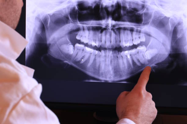 Best Emergency Dental Care for Broken or Chipped Teeth in Etowah, TN
